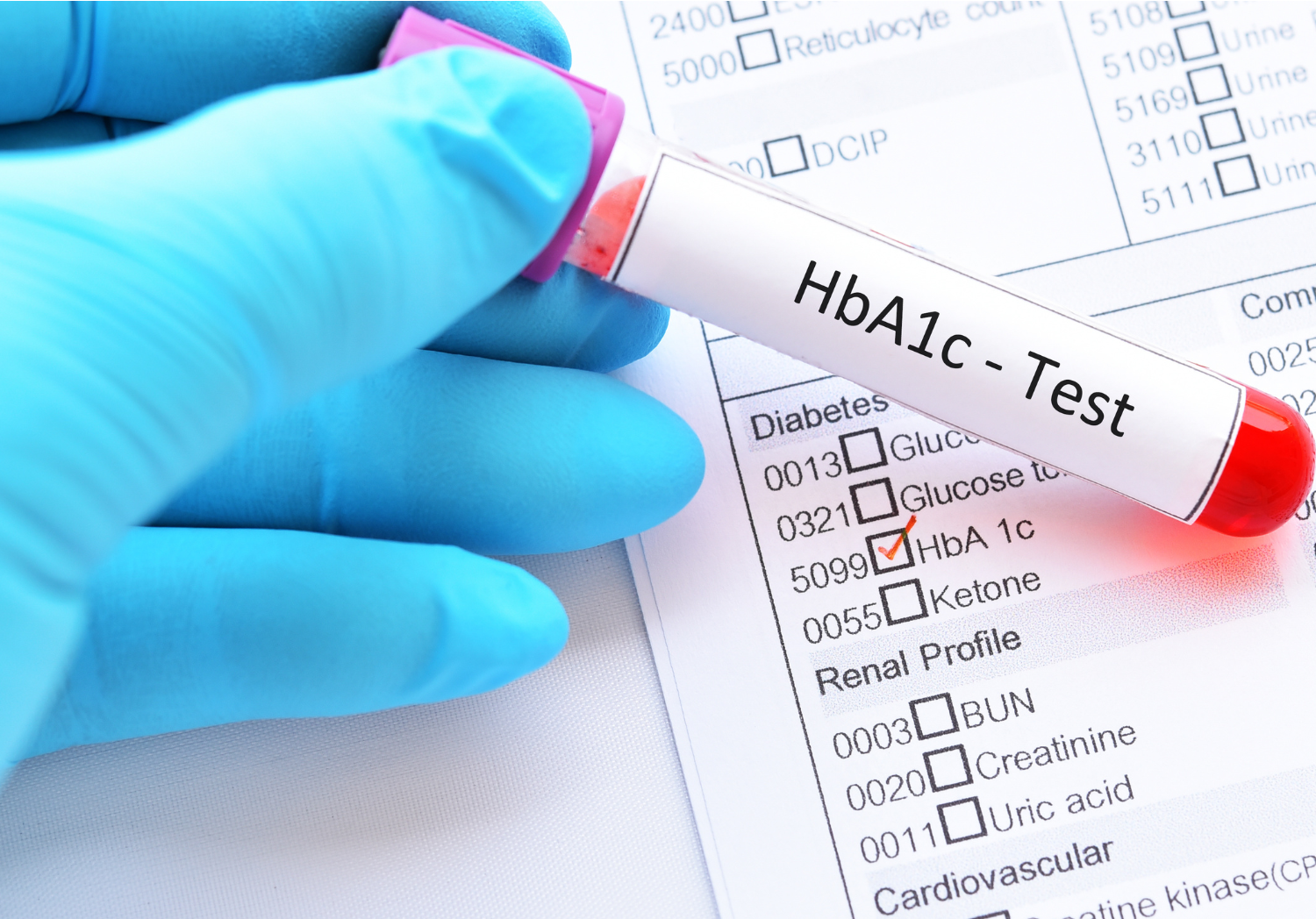 HbA1c waarde