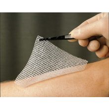 Foto van Lomatuell H gaasverband 10 cm x 10 cm