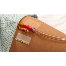 Foto van Dale Katheter fixatiepleister